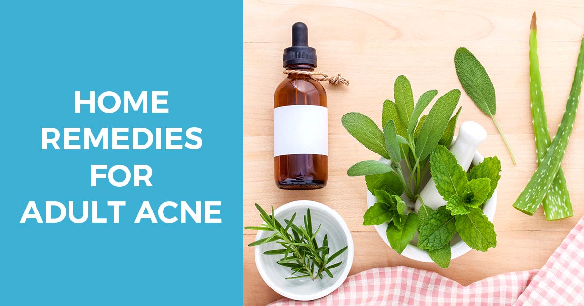home remedies for adult acne treatment