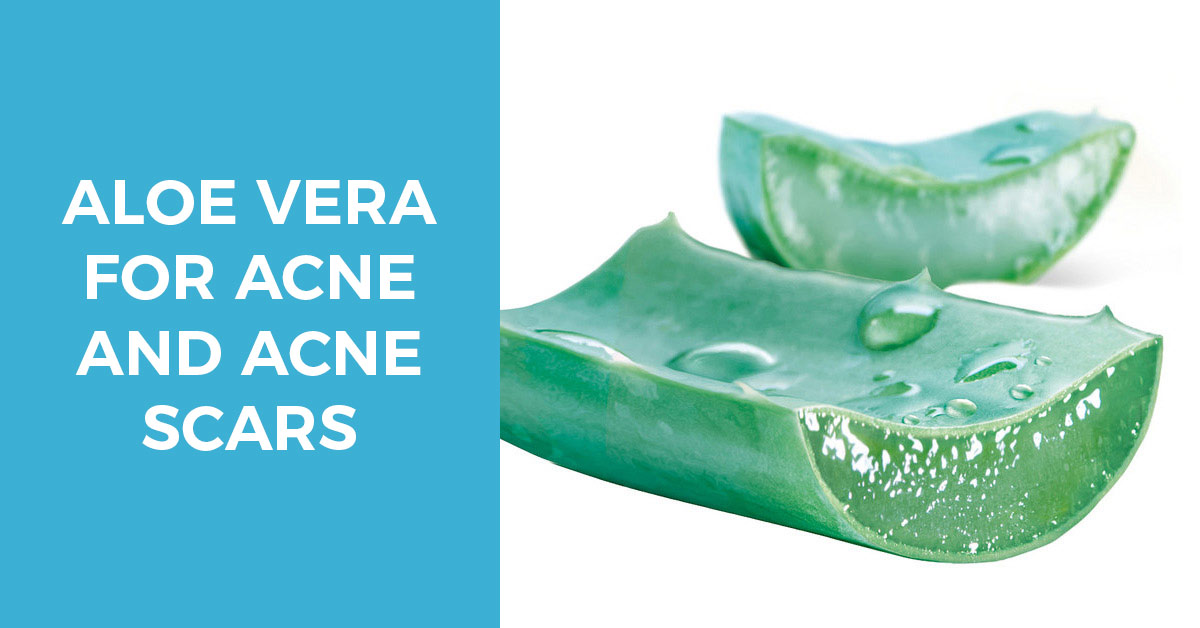 use aloe vera to treat acne and acne scars