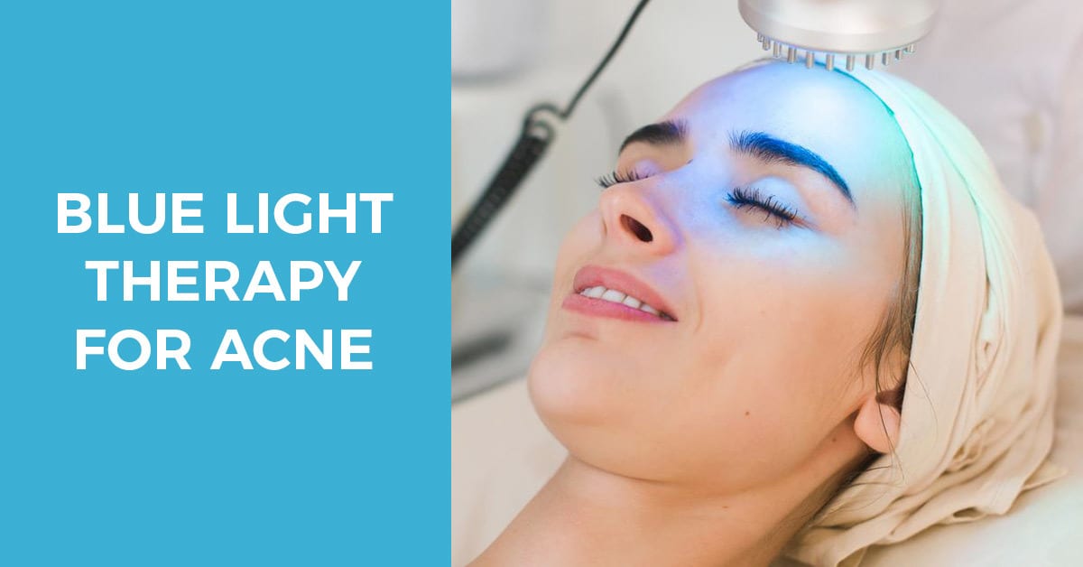 Using blue light therapy for acne problems