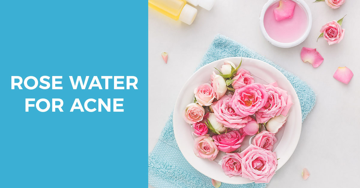 Benefits of rose water for acne prone skin