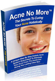 Acne no more
