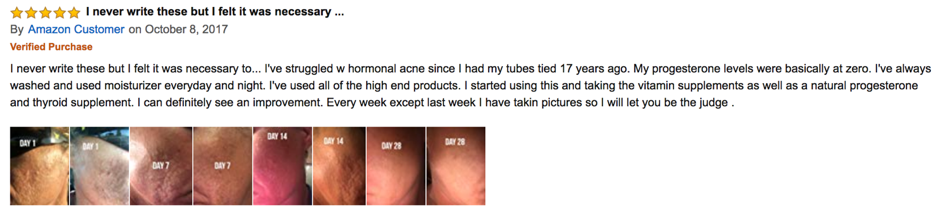 A positive customer review on Exposed Skin Care