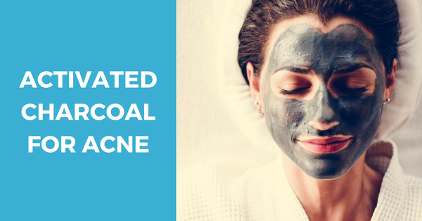 Use Activated Charcoal for Acne! The Why and The How