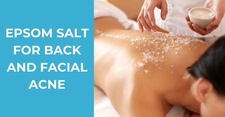 How to Use Epsom Salt for Back and Facial Acne Effectively – 8 All-Natural Recipes