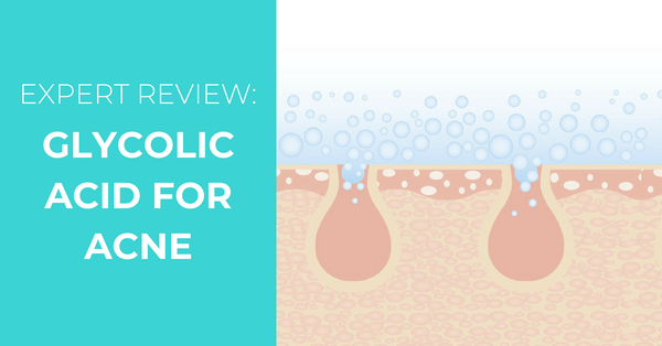 Glycolic Acid for Acne – An Expert Review