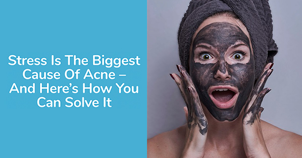 Stress Is The Biggest Cause Of Acne