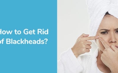 How to Get Rid of Blackheads?