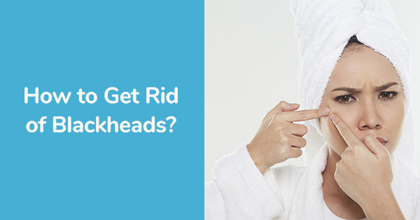 How to Get Rid of Blackheads?