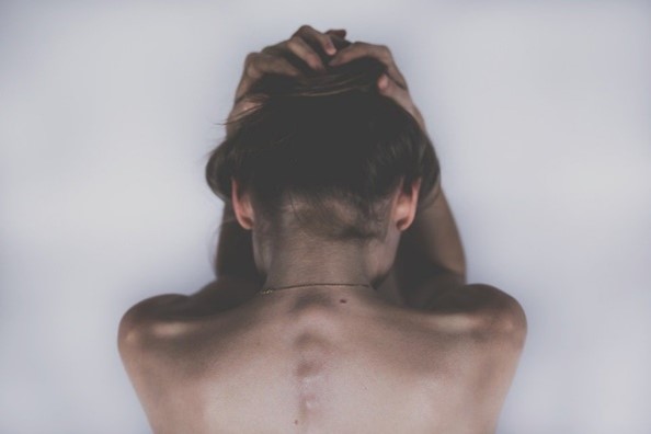 Back Acne Prevention habits to treat back acne